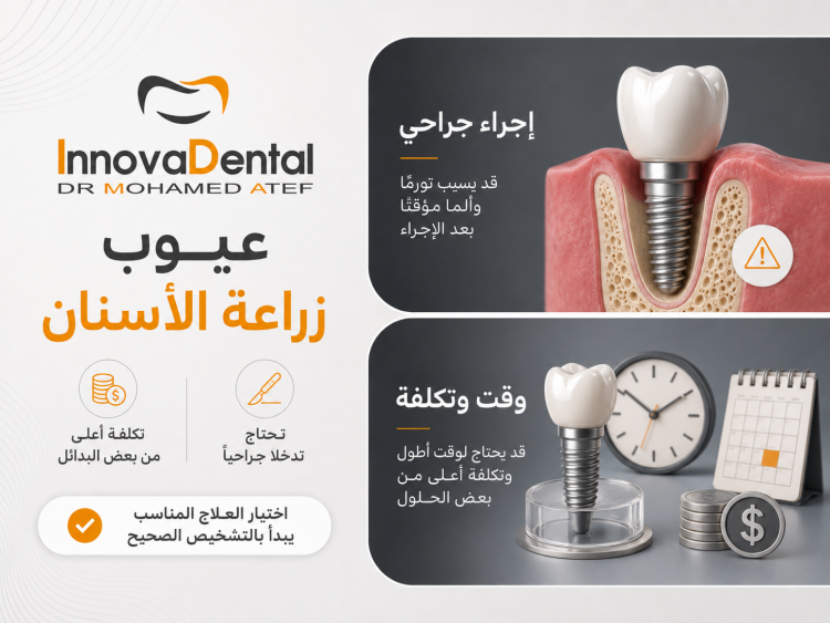 عيوب زراعة الاسنان ومخاطرها: هل تستحق التجربة رغم ذلك؟